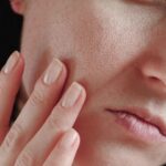 rostro con puntos nregros, rostro reseco, resequedad, fisiogel, fisiogel hipoalergenico, fisiogel cuidado hidratante, crema liquida, fisiogel piel seca, fisiogel para piel sensible, fisiogel crema liquida